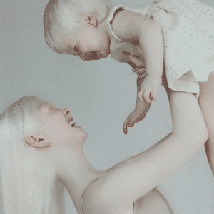 SC “Mesmerizing: Two Albino Sisters, 12 Years Apart, Embrace Fashion as Beloved Phenomena!” SC