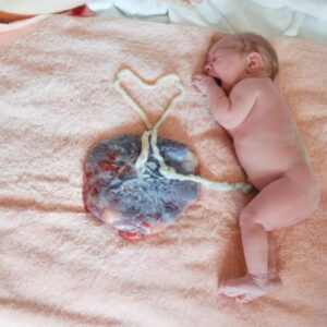 SS.The word “LOVE” is outlined by the dramatic picture of a newborn’s umbilical chord, surprising many with its unexpected beauty.